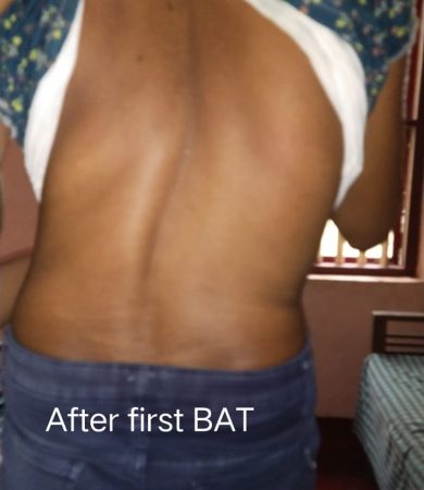 BAT2